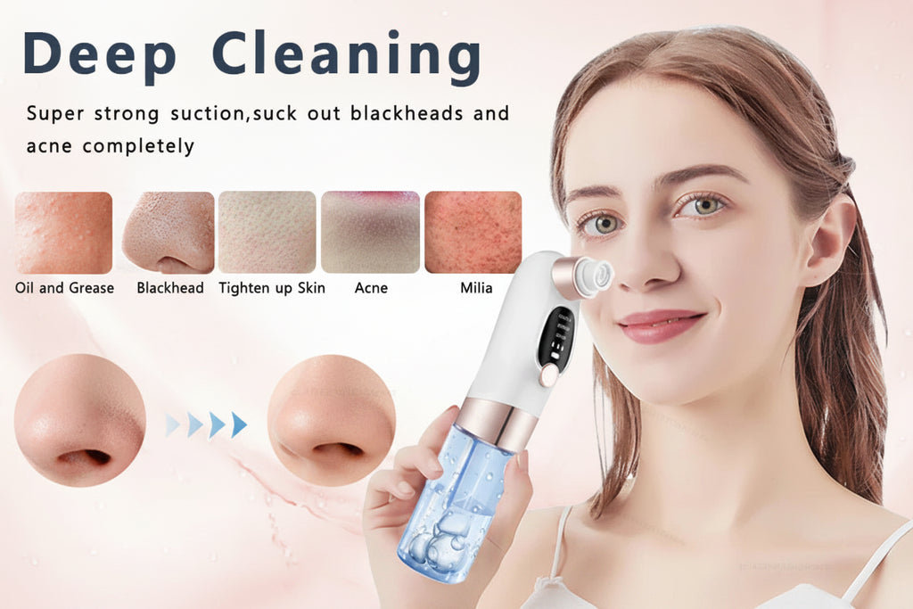 Electric Blackhead Remover & Pore Vacuum | USB Rechargeable