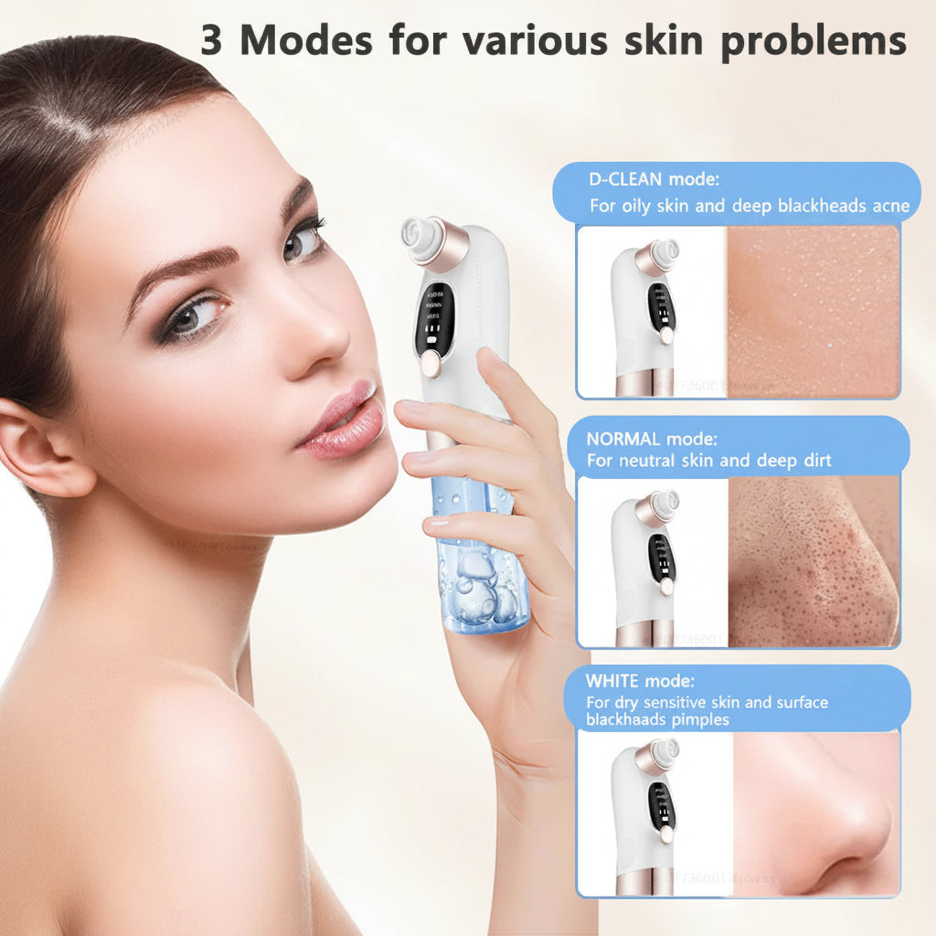 Electric Blackhead Remover & Pore Vacuum | USB Rechargeable