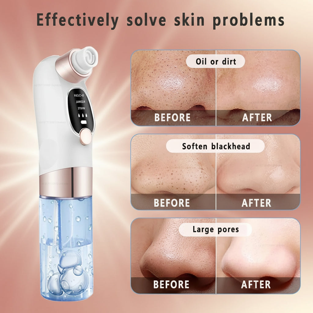 Electric Blackhead Remover & Pore Vacuum | USB Rechargeable